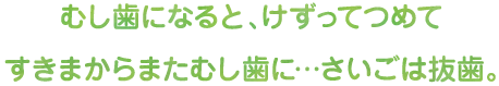 むし歯になると、けずってつめてすきまからまたむし歯に…さいごは抜歯。